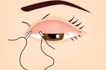 双眼皮动漫77.jpg 双眼皮动漫77.jpg