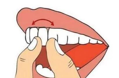 牙齿松动动漫01.jpg 牙齿松动动漫01.jpg