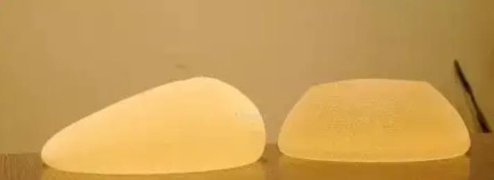 隆胸dm72.jpg 隆胸dm72.jpg
