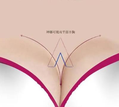 隆胸31.jpg 隆胸31.jpg