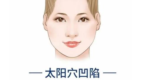 太阳穴凹陷h11.jpg 太阳穴凹陷h11.jpg