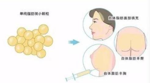 自体填充动漫2.jpg 自体填充动漫2.jpg