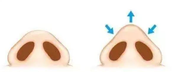 鼻头缩小2.jpg