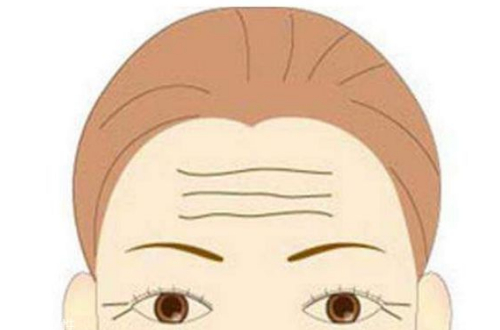 抬头纹怎么祛除？热门方法及优势集中一览~