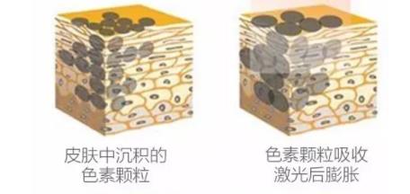 洗眉毛动漫01.jpg