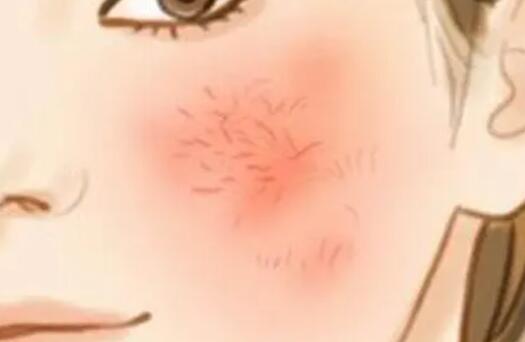 去红血丝动漫02.jpg 去红血丝动漫02.jpg