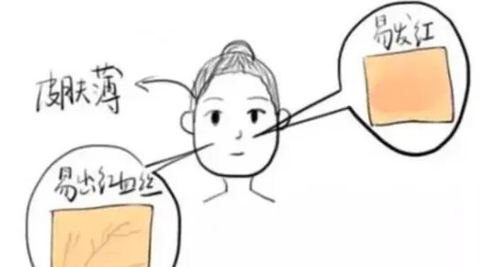 去红血丝动漫14.jpg 去红血丝动漫14.jpg