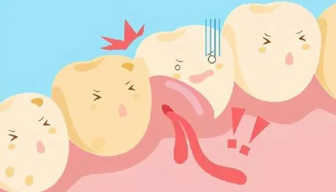 牙龈脓包动漫01.jpg 牙龈脓包动漫01.jpg