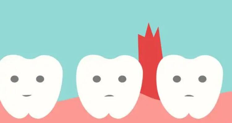 牙龈脓包动漫03.jpg 牙龈脓包动漫03.jpg