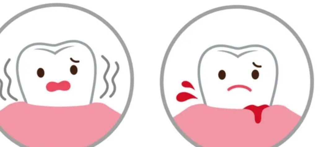 牙龈脓包动漫02.jpg 牙龈脓包动漫02.jpg