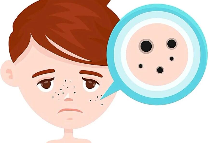 祛斑动漫44.jpg 祛斑动漫44.jpg