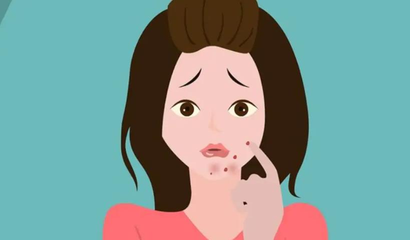 长痘04.jpg 长痘04.jpg