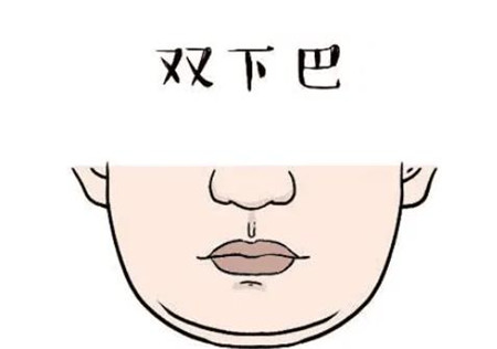 西京医院整形科垫下巴怎么样？快来看看我的亲身经历！