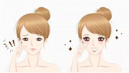 上海杜园园双眼皮技术好吗？看完案例你就清楚知道实力了~
