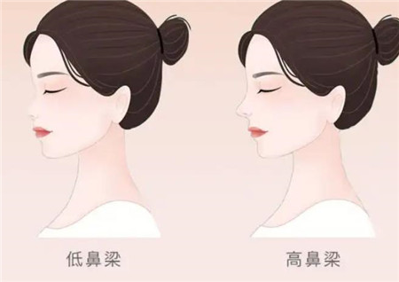 北京协和医院整形外科隆鼻怎么样?假体隆鼻手术过程一览+价格表收费详情