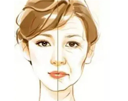 在北京联合丽格做拉皮是什么的体验？分享手术过程及医生！