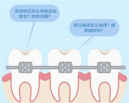 广州穗江口腔医院牙齿矫正案例分享！来看看牙友反馈技术好不好？