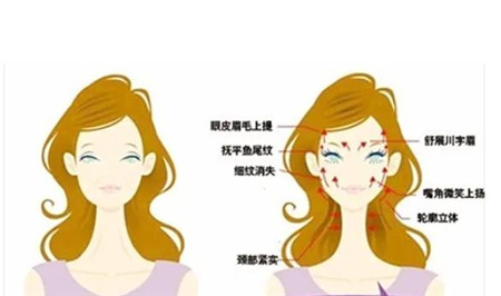 【记录面部提升前后变化】她用手术逆袭成功,不再被岁月打败