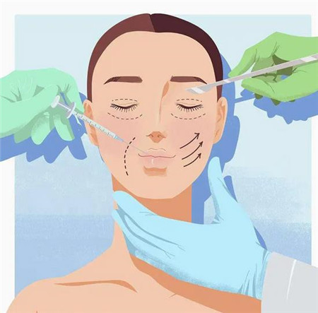 深圳北大医院双眼皮失败修复怎么样?以下真实分享双眼皮修复过程