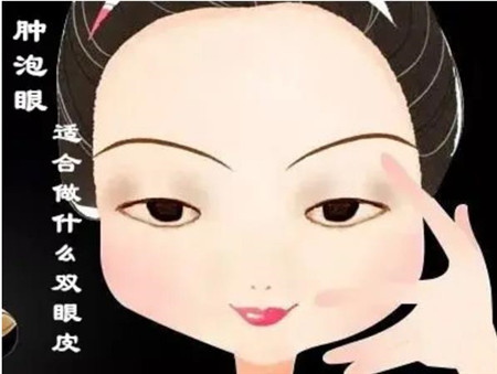 宁波市第二医院双眼皮失败修复怎么样?分享我的整形经历以及价格表_附价目表一览