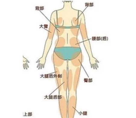 水动力吸脂术有哪些优点，会疼吗