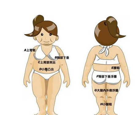 武汉亚韩整形外科医院腰腹吸脂怎么样?吸脂真实经历分享~效果值得推荐!