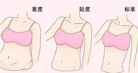夏天吸脂后恢复需要多长时间