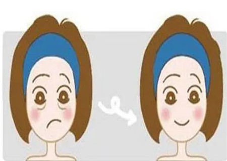 镇江芘丽芙美容医院拉皮怎么样?做完面部拉皮手术后脸上的法令纹消失不见了