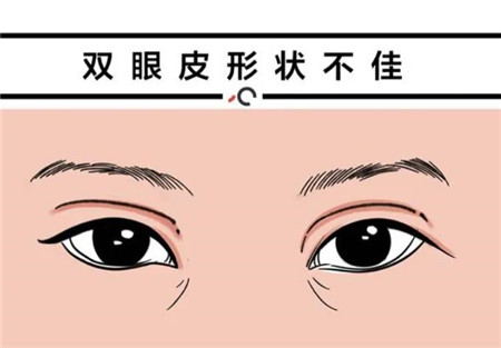 上海第一人民医院整形科做割双眼皮怎么样？看完案例你就清楚知道实力了~