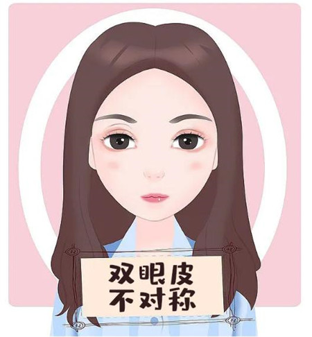 双眼皮需要修复的情况有哪些?
