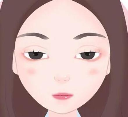 什么是矫正上睑下垂,矫正需要做几次