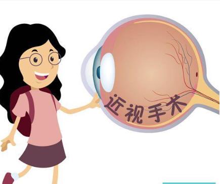 近视手术3.jpg