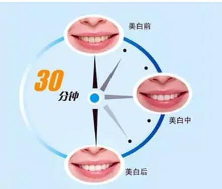冷光美白会不会反弹?步骤是怎么样的