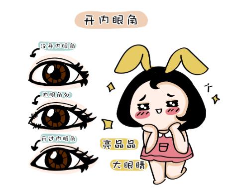 影响开眼角手术恢复期的因素有哪些