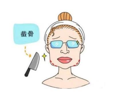 下颌角截骨术的特点是什么,风险有哪些
