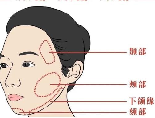 颏部整形手术.jpg