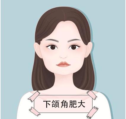 下颌角磨削要花多少钱，是怎么做的