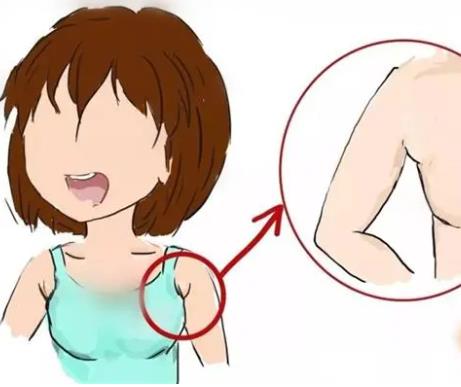 副乳切除术.jpg