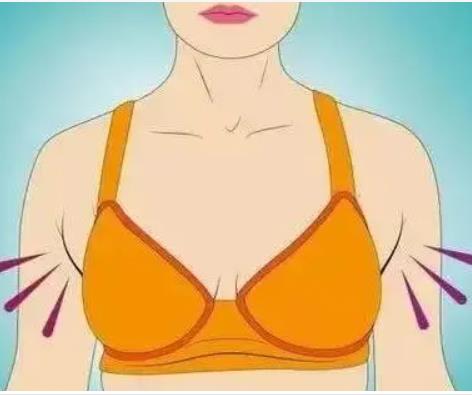 影响副乳切除术价格的因素有哪些?