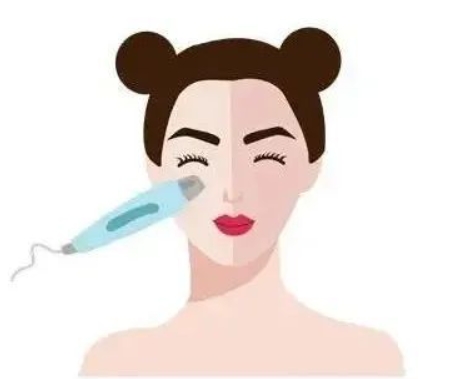 激光美容有哪些后遗症,注意事项有哪些