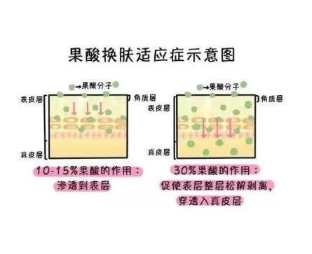 什么是果酸换肤,优点和缺点是什么