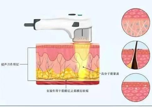 超声刀.jpg