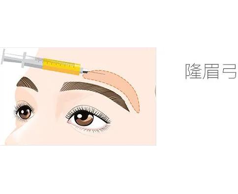 用什么填充眉弓比较好,填充眉弓后怎么护理