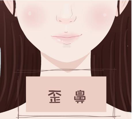 有哪些矫正歪鼻的方法