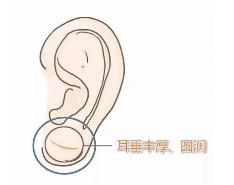 耳垂增大3.jpg