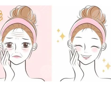 彩光嫩肤有哪些优点,可以收缩毛孔吗?