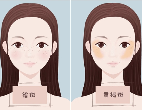 什么是皮秒激光,作用和风险有哪些