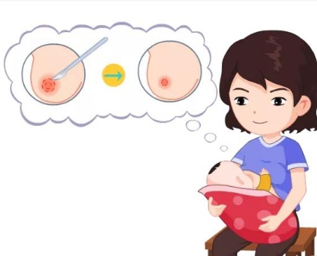 乳头缩小1.jpg