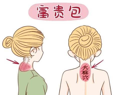 富贵包.jpg