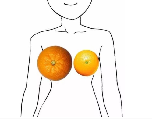 巨乳缩小手术.jpg